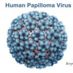 Infección-por-el-Virus-del-Papiloma-Humano-VPH-300x219
