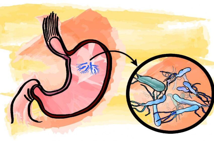 helicobacter-850x560